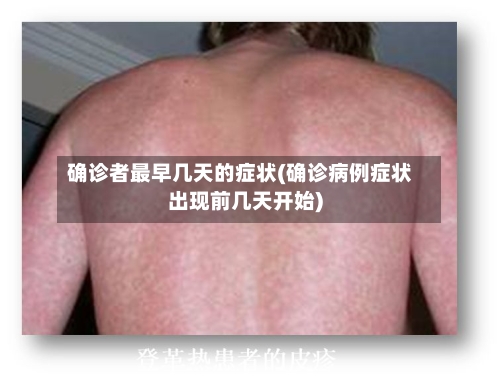 确诊者最早几天的症状(确诊病例症状出现前几天开始)