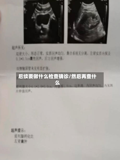 后续要做什么检查确诊/然后再查什么-第2张图片