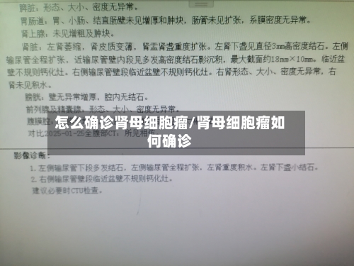 怎么确诊肾母细胞瘤/肾母细胞瘤如何确诊