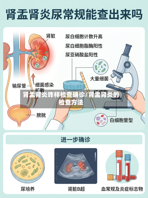 肾盂肾炎咋样检查确诊/肾盂肾炎的检查方法