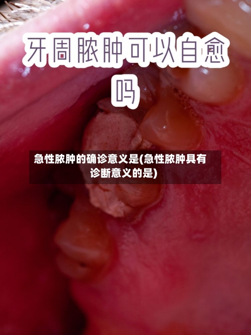 急性脓肿的确诊意义是(急性脓肿具有诊断意义的是)-第2张图片