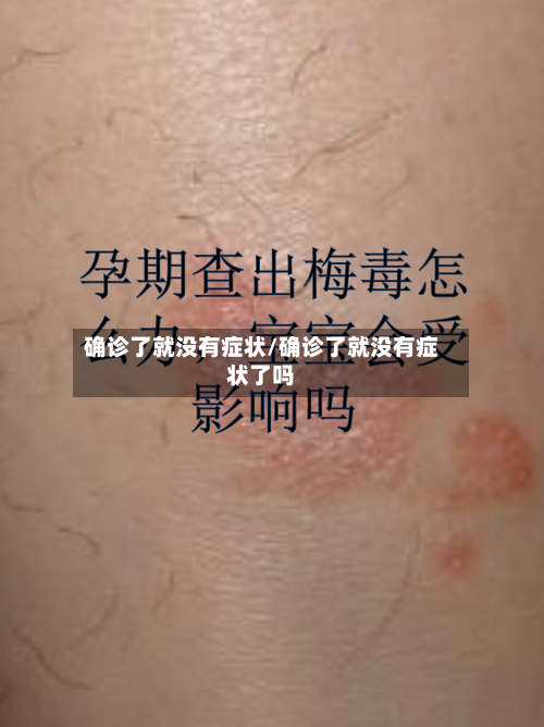 确诊了就没有症状/确诊了就没有症状了吗