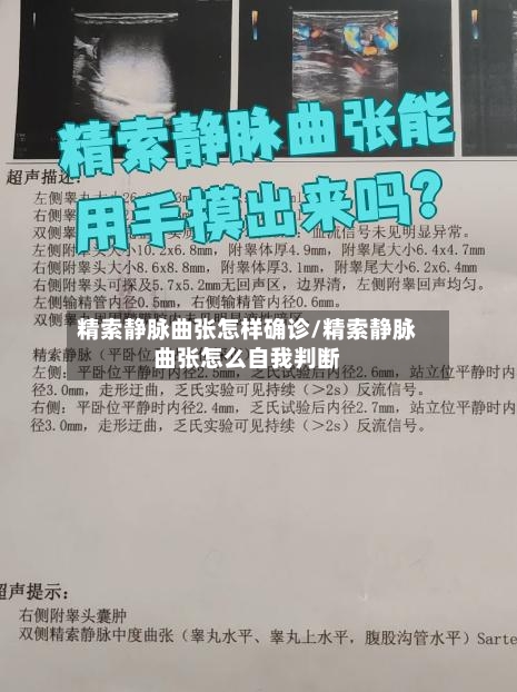 精索静脉曲张怎样确诊/精索静脉曲张怎么自我判断-第2张图片