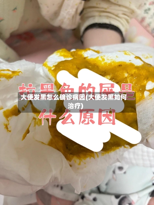 大便发黑怎么确诊病因(大便发黑如何治疗)