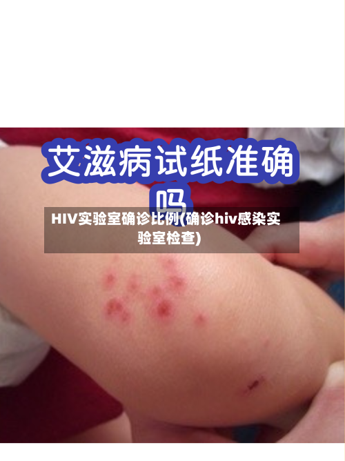HIV实验室确诊比例(确诊hiv感染实验室检查)