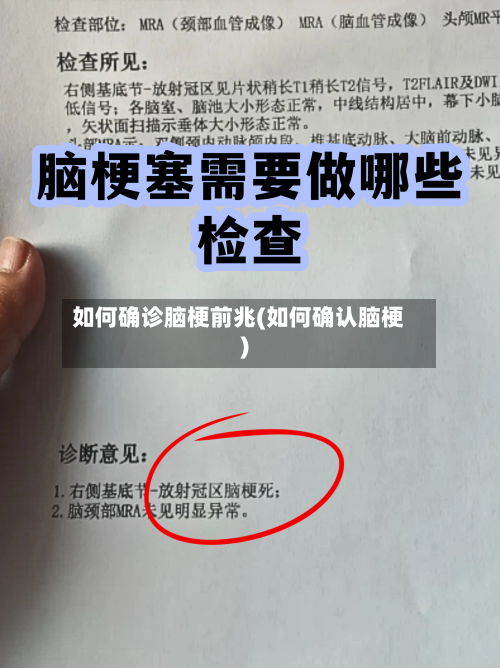 如何确诊脑梗前兆(如何确认脑梗)