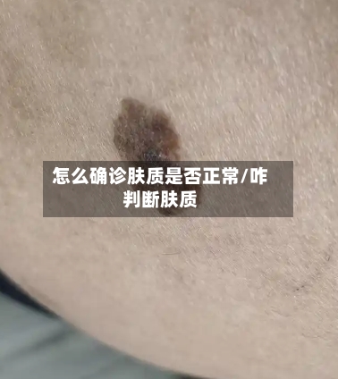 怎么确诊肤质是否正常/咋判断肤质-第2张图片