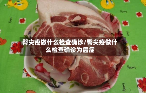 臀尖疼做什么检查确诊/臀尖疼做什么检查确诊为癌症