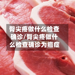 臀尖疼做什么检查确诊/臀尖疼做什么检查确诊为癌症-第2张图片