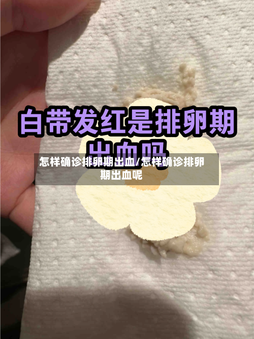 怎样确诊排卵期出血/怎样确诊排卵期出血呢