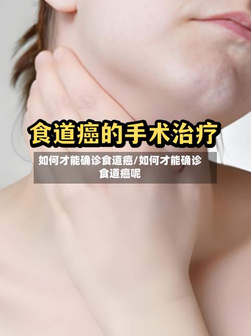 如何才能确诊食道癌/如何才能确诊食道癌呢-第3张图片