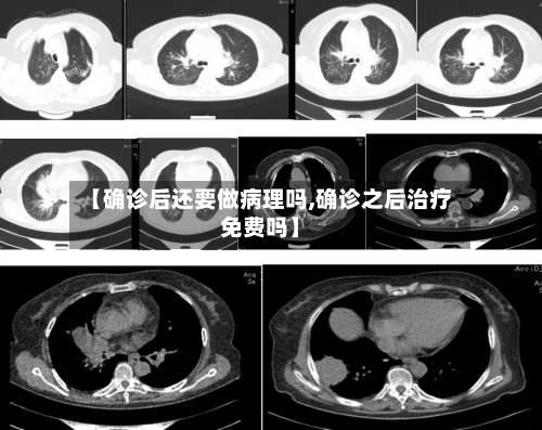 【确诊后还要做病理吗,确诊之后治疗免费吗】-第2张图片