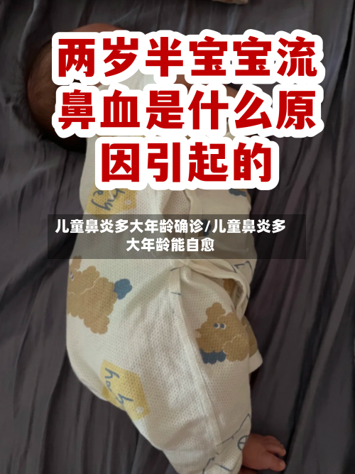 儿童鼻炎多大年龄确诊/儿童鼻炎多大年龄能自愈-第2张图片