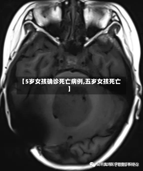 【5岁女孩确诊死亡病例,五岁女孩死亡】-第3张图片