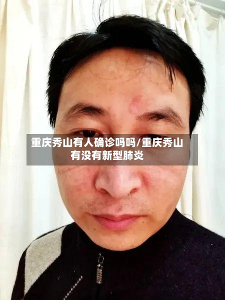 重庆秀山有人确诊吗吗/重庆秀山有没有新型肺炎