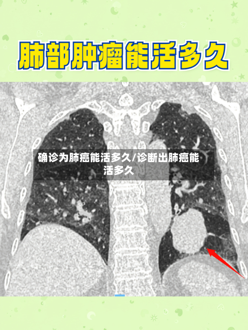 确诊为肺癌能活多久/诊断出肺癌能活多久