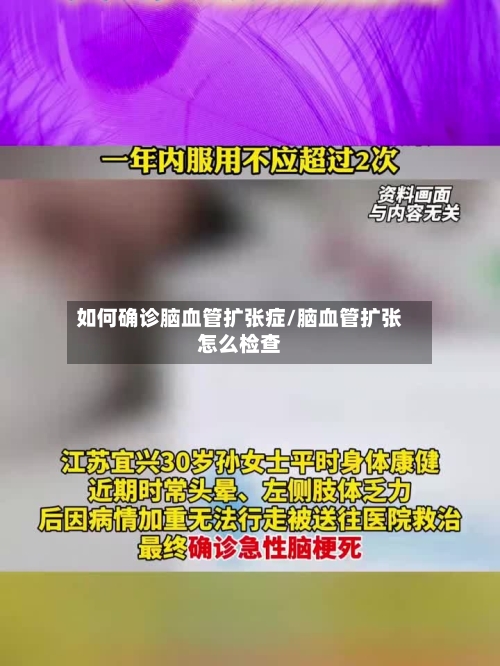 如何确诊脑血管扩张症/脑血管扩张怎么检查