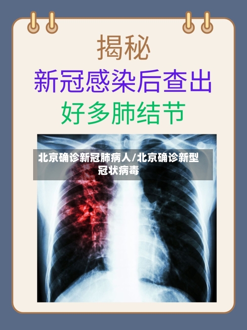 北京确诊新冠肺病人/北京确诊新型冠状病毒-第3张图片