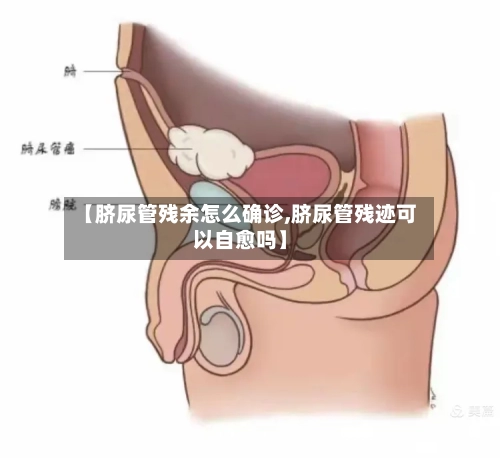 【脐尿管残余怎么确诊,脐尿管残迹可以自愈吗】-第2张图片