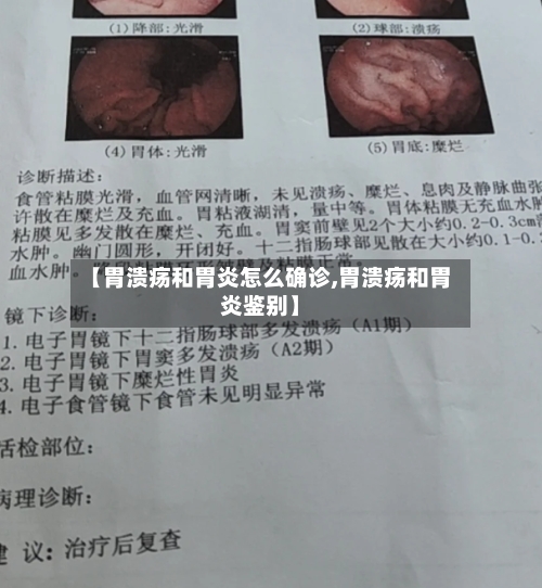 【胃溃疡和胃炎怎么确诊,胃溃疡和胃炎鉴别】-第2张图片