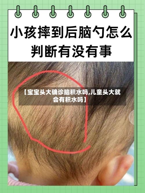 【宝宝头大确诊脑积水吗,儿童头大就会有积水吗】