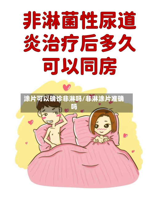 涂片可以确诊非淋吗/非淋涂片准确吗-第2张图片
