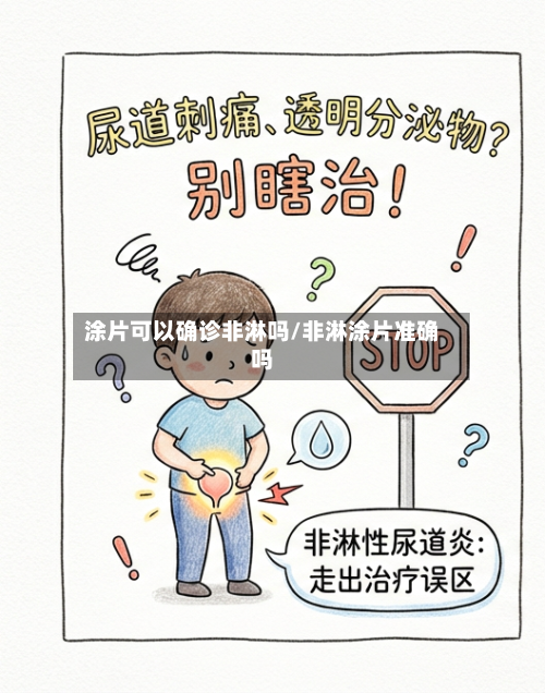涂片可以确诊非淋吗/非淋涂片准确吗-第3张图片
