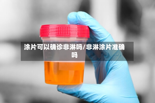涂片可以确诊非淋吗/非淋涂片准确吗