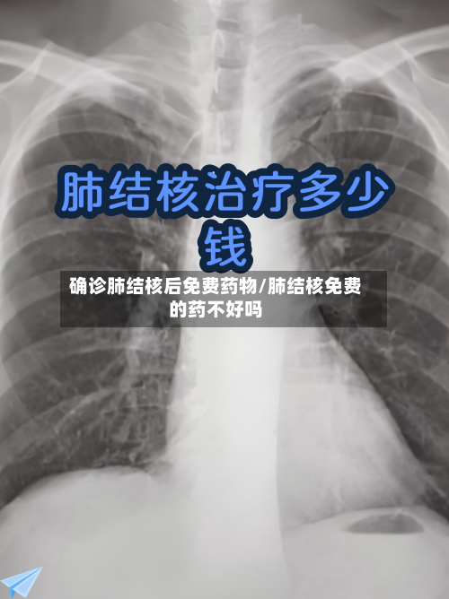 确诊肺结核后免费药物/肺结核免费的药不好吗