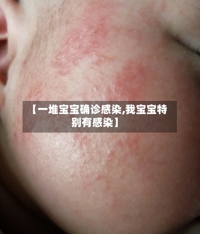 【一堆宝宝确诊感染,我宝宝特别有感染】-第3张图片