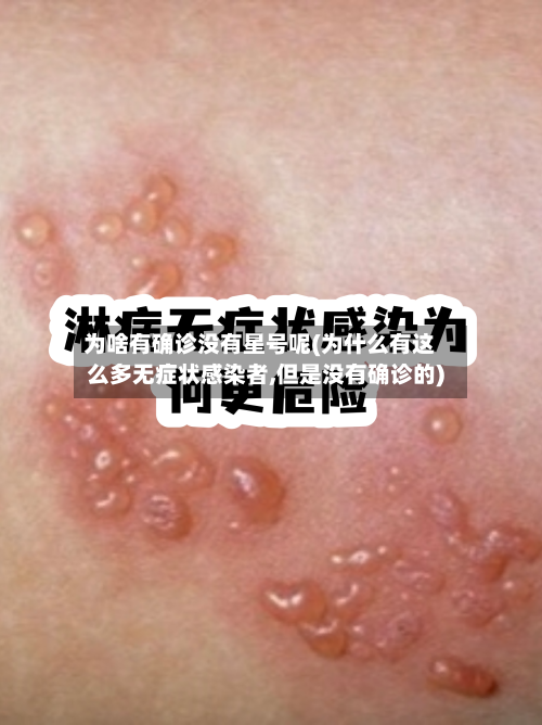 为啥有确诊没有星号呢(为什么有这么多无症状感染者,但是没有确诊的)-第2张图片