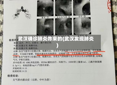武汉确诊肺炎咋来的(武汉发现肺炎)