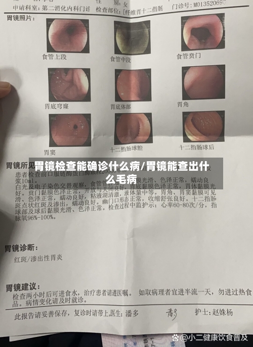 胃镜检查能确诊什么病/胃镜能查出什么毛病-第2张图片