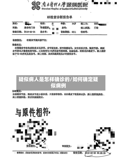 疑似病人是怎样确诊的/如何确定疑似病例