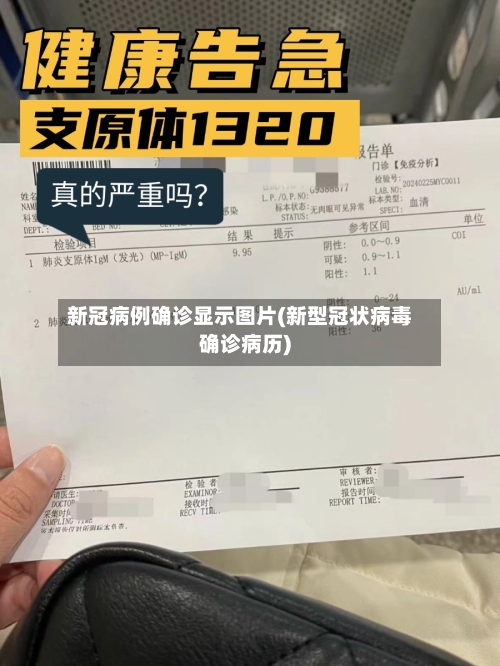 新冠病例确诊显示图片(新型冠状病毒确诊病历)