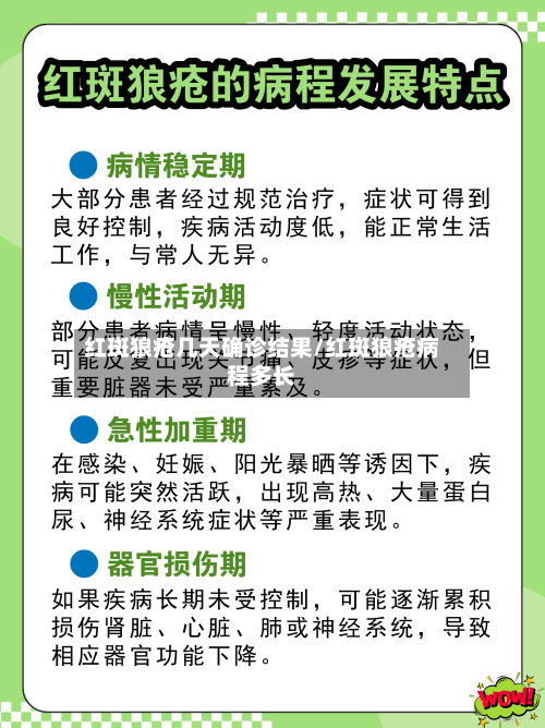 红斑狼疮几天确诊结果/红斑狼疮病程多长-第2张图片