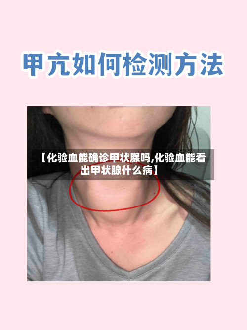 【化验血能确诊甲状腺吗,化验血能看出甲状腺什么病】-第2张图片