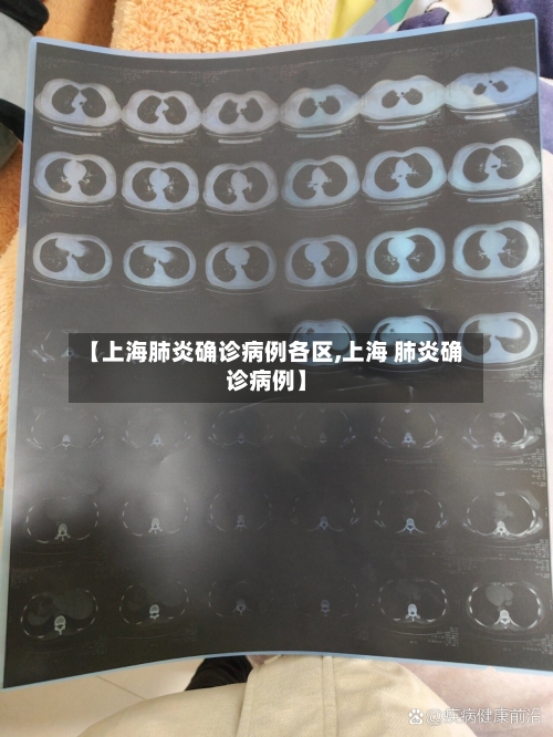 【上海肺炎确诊病例各区,上海 肺炎确诊病例】-第2张图片